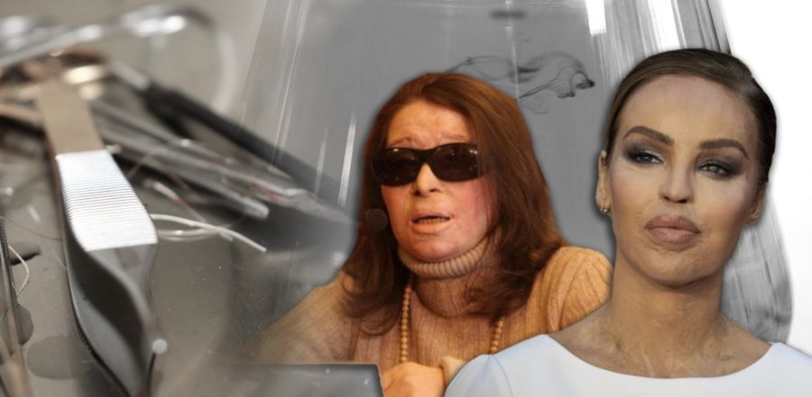 Επιθέσεις με βιτριόλι: Από την Ελλάδα των απατημένων του ...